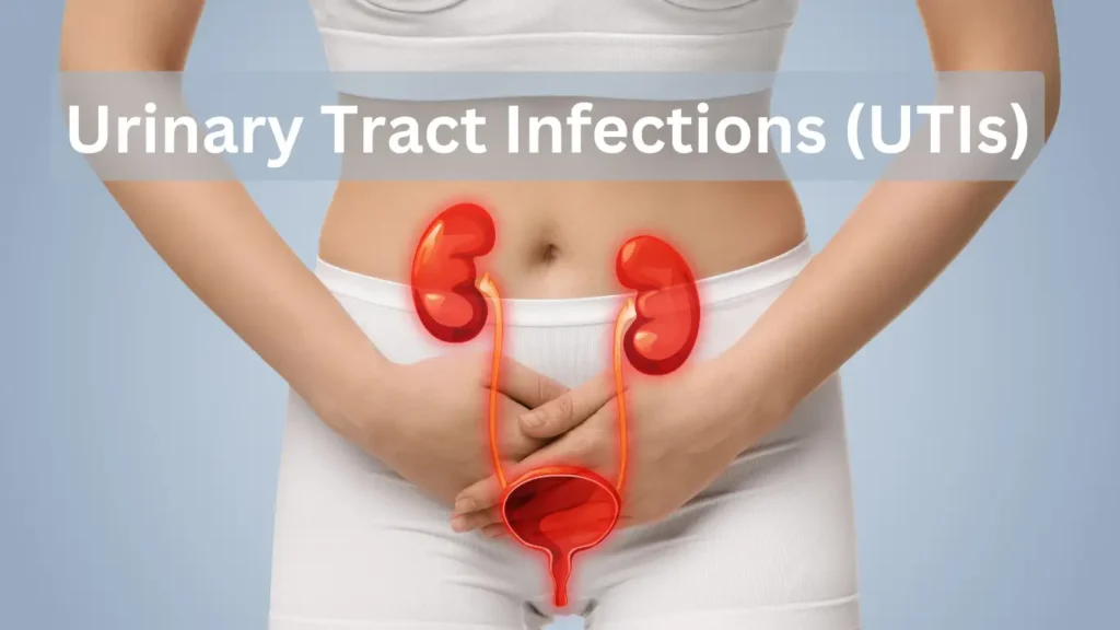 Urinary Tract Infections (UTIs) - Understanding Causes, Symptoms, and Treatment