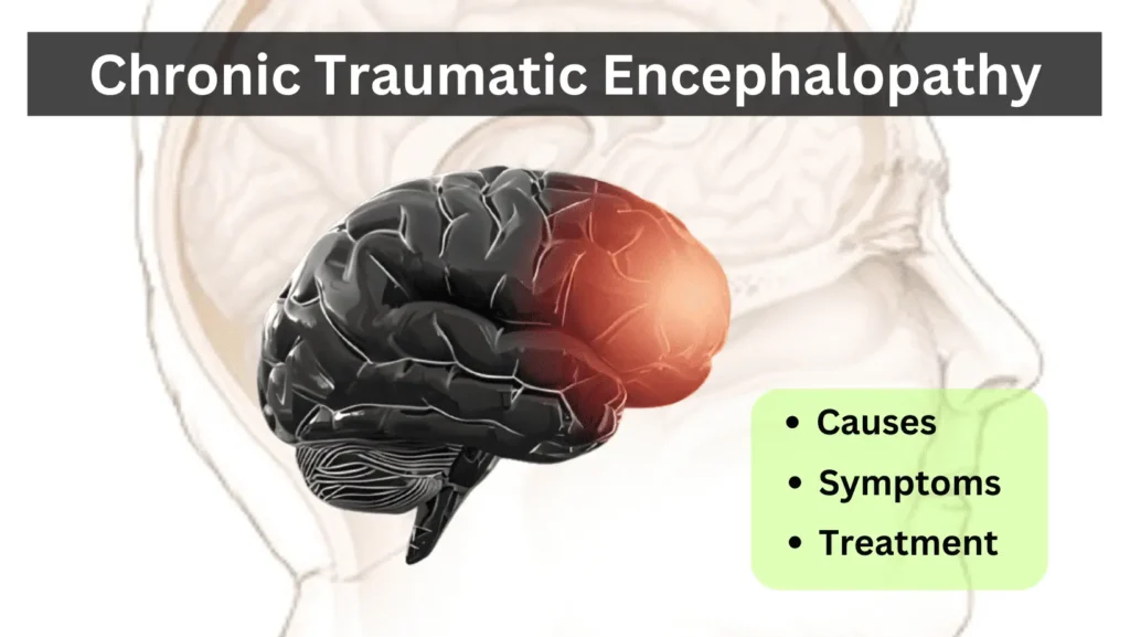 Chronic traumatic encephalopathy