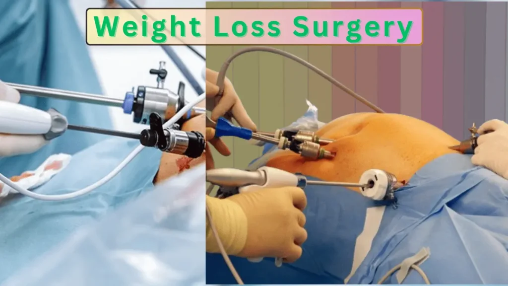 weight loss surgery before and after