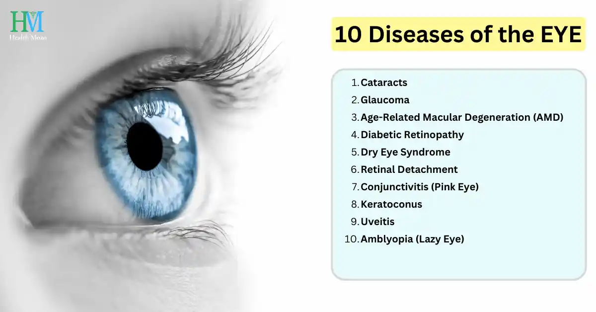 10 diseases of the eye | A variety of eye conditions affecting vision and eye health, highlighting symptoms, causes, and treatment options.