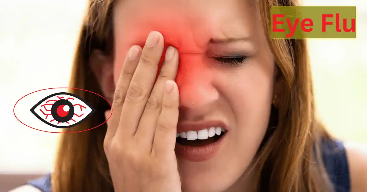 Illustration of a human eye with redness and irritation, representing symptoms of eye flu.