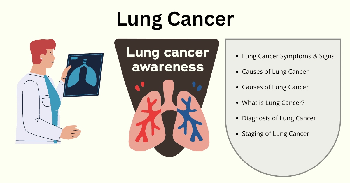 a diagram of lung cancer
