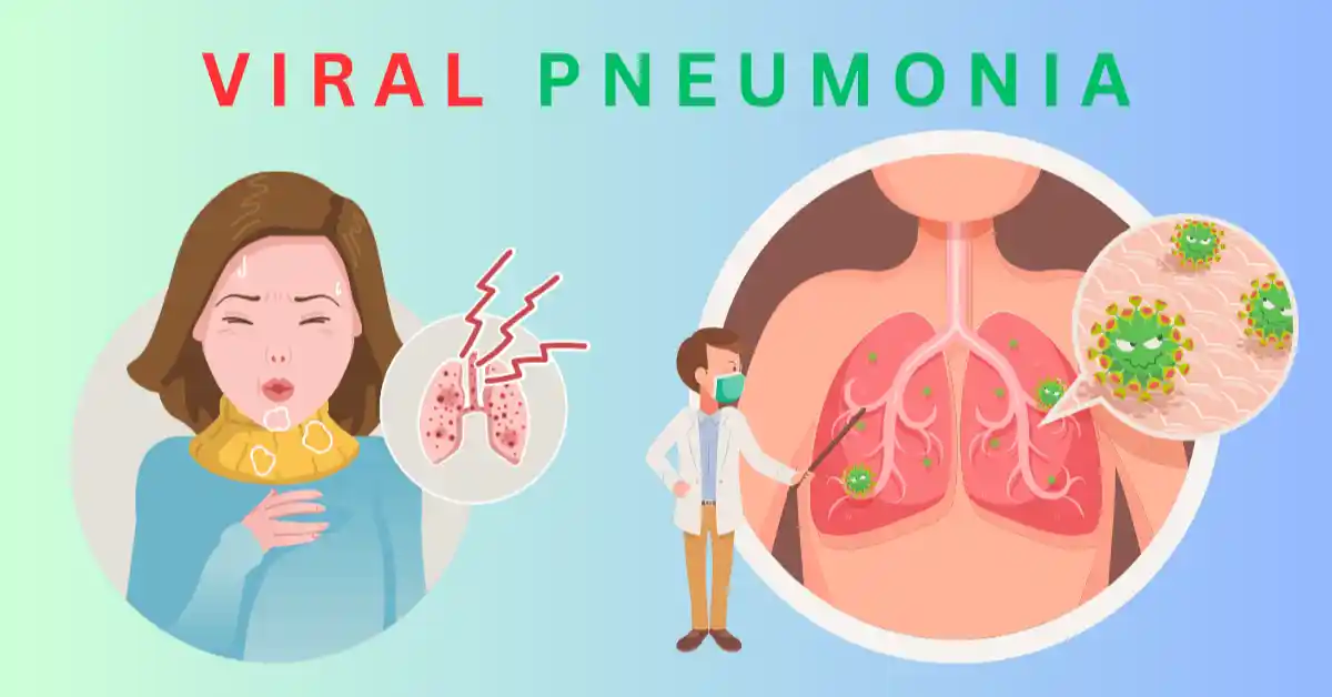 viral pneumonia