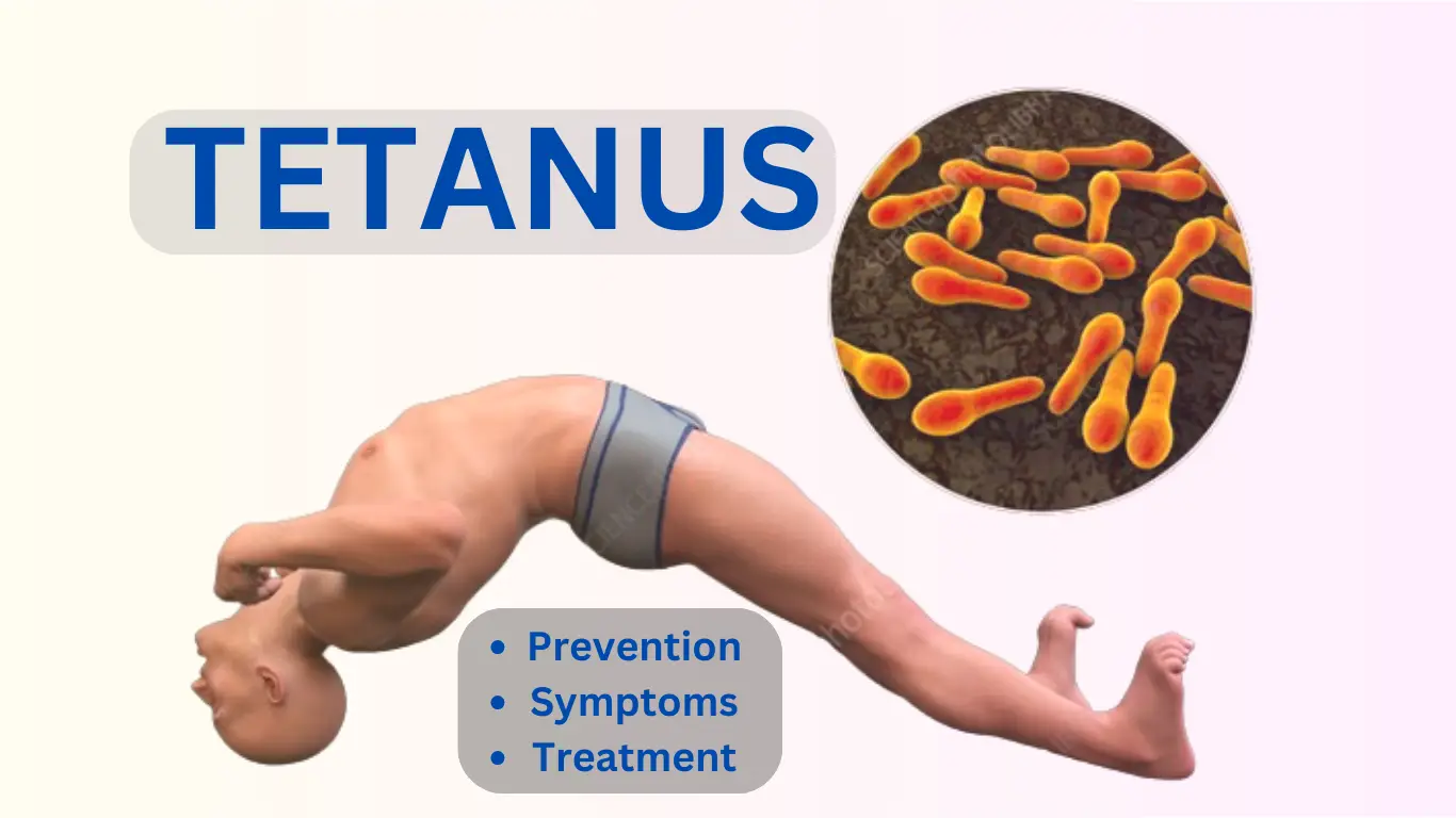 Tetanus Prevention Symptoms and Treatment