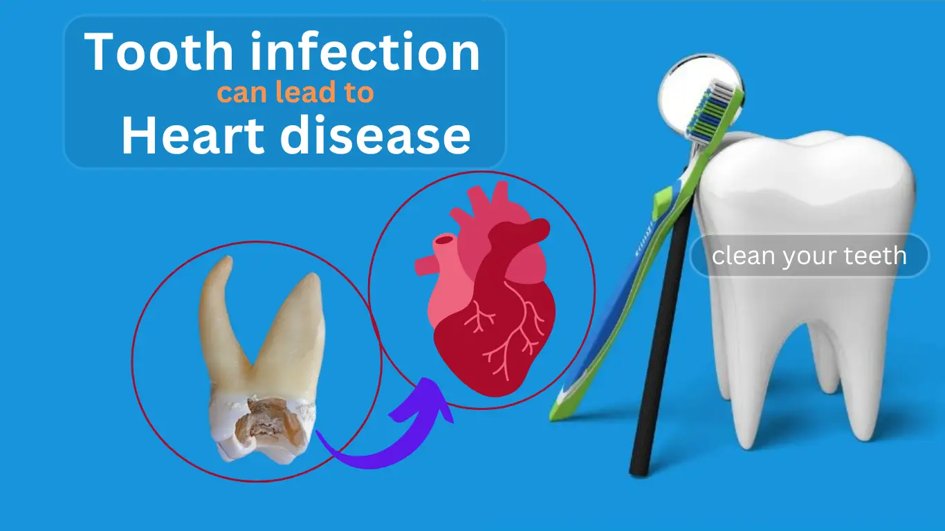 heart disease from tooth infection