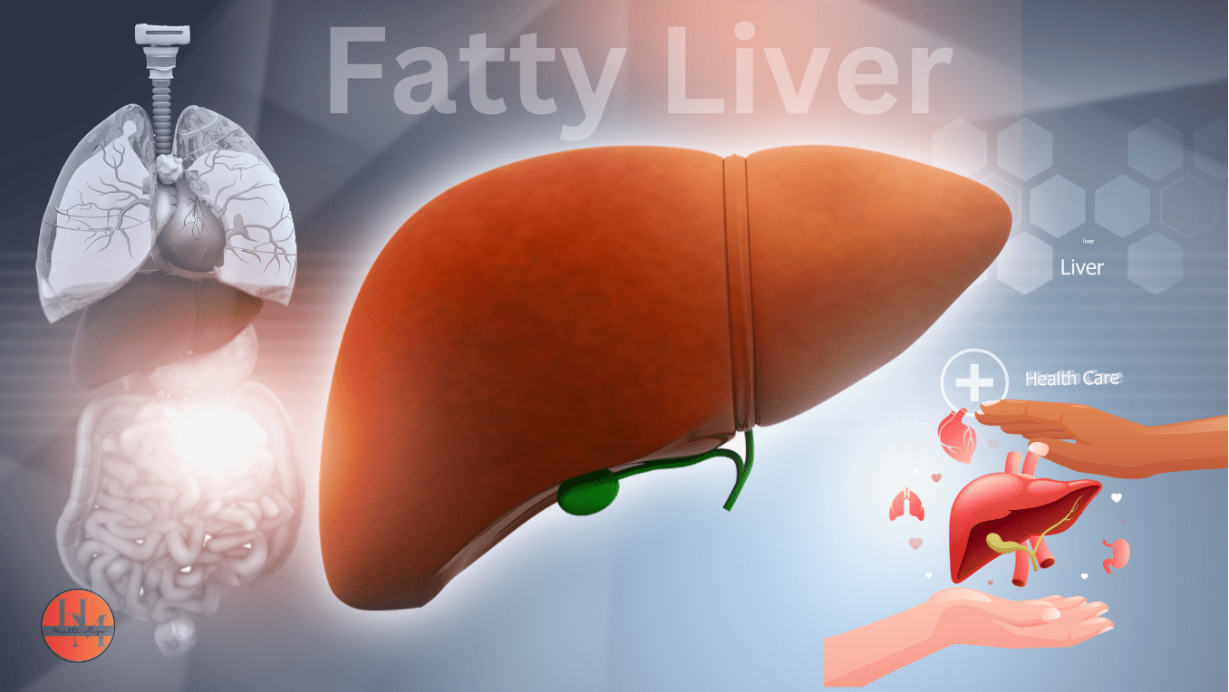 Illustration of Fatty Liver Disease highlighting liver health and potential complications