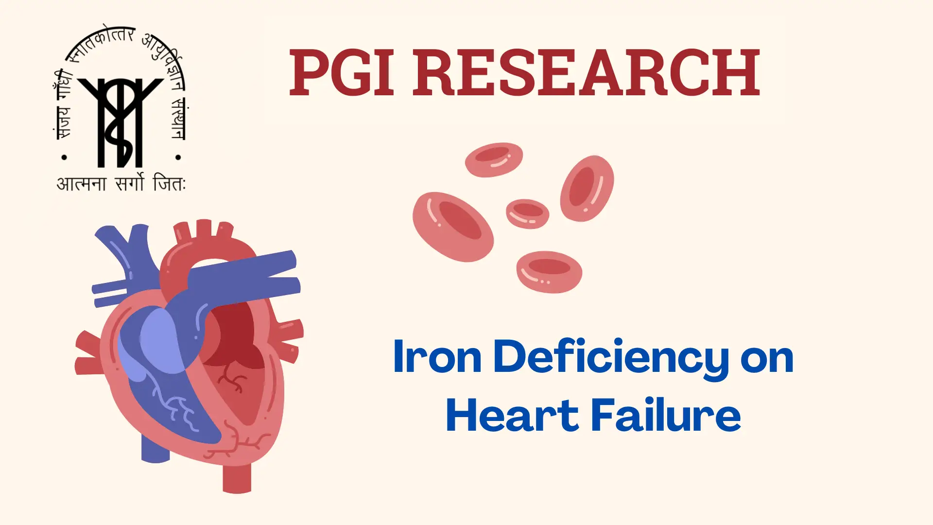 Heart Failure PGI research 2024: Infographic showing the impact of iron deficiency on heart failure.