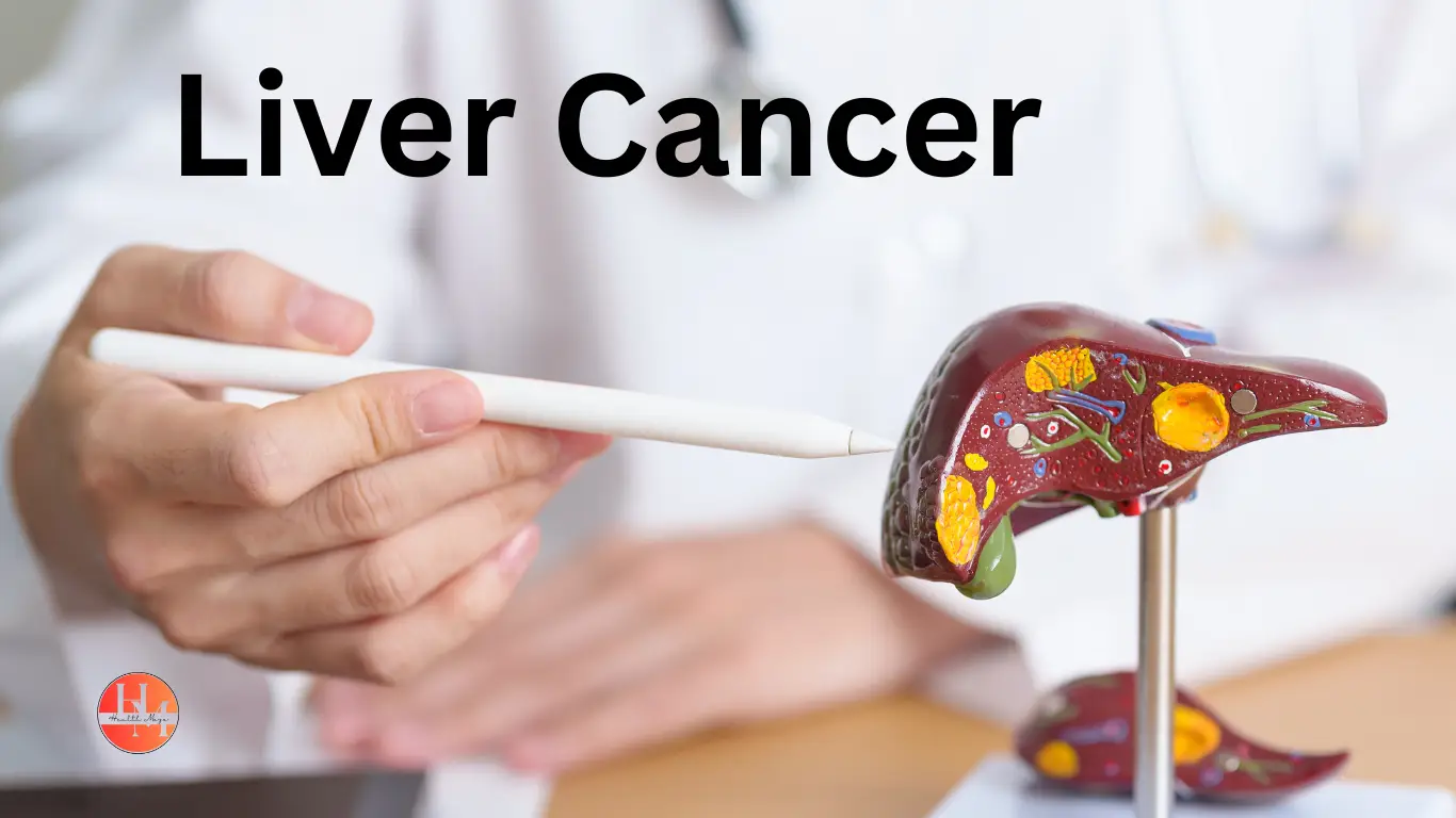 Liver cancer disease illustration highlighting affected areas